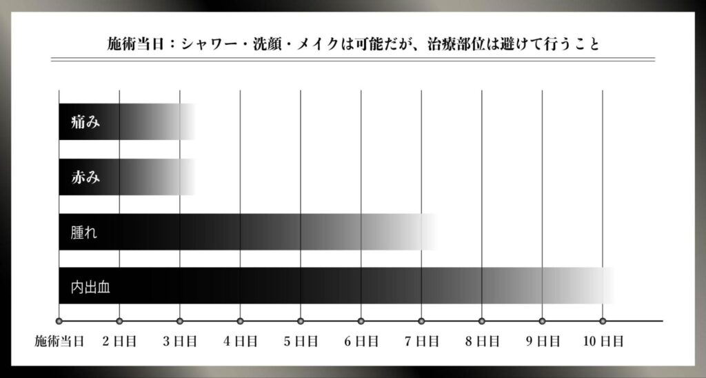 サブシジョン ダウンタイム