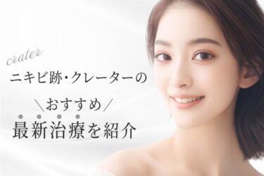 ニキビ跡・クレーターのおすすめ最新治療を紹介