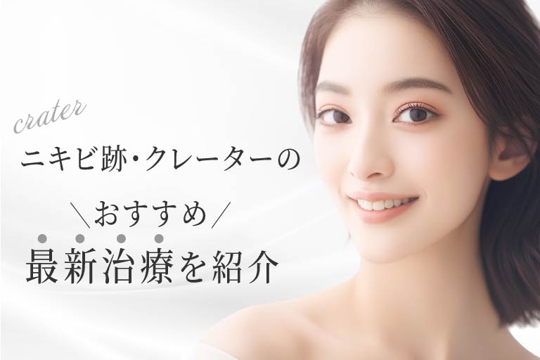 ニキビクレーター治療