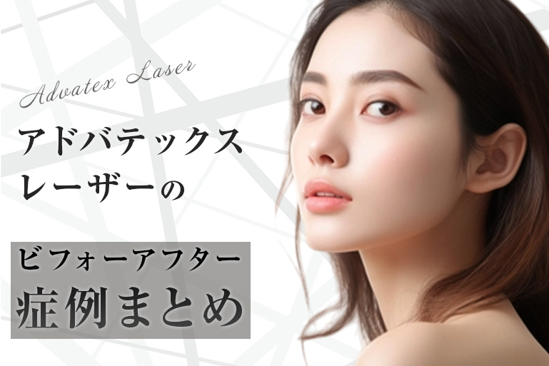 アドバテックスレーザー症例