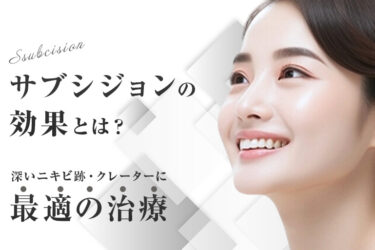 サブシジョンの効果とは？深いニキビ跡・クレーターに最適の治療