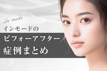インモードのビフォーアフター症例まとめ