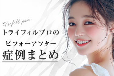 トライフィルプロのビフォーアフター症例まとめ