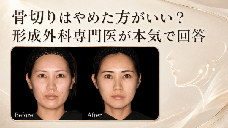 骨切り やめた方がいい