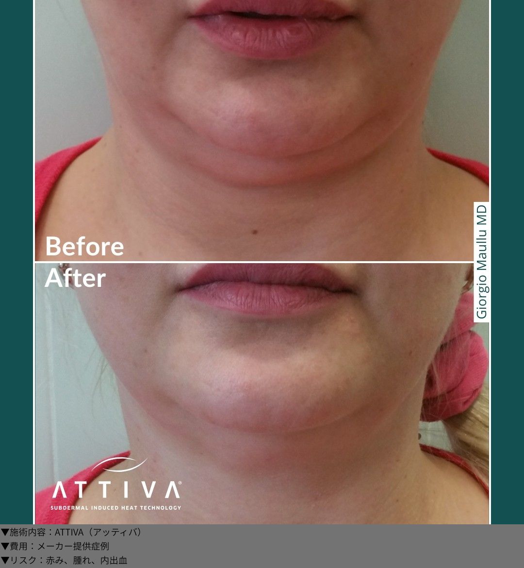 ATTIVA（アッティバ）