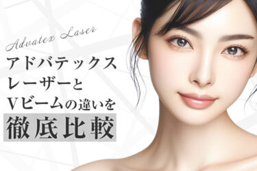 アドバテックスレーザーとVビームの違いを徹底比較