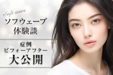 ソフウェーブのビフォーアフターを症例画像で確認
