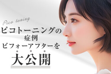 ピコトーニングの症例ビフォーアフターを大公開