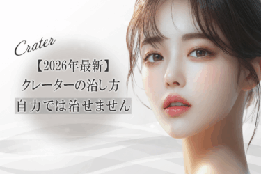 【2026年最新】クレーターの治し方【自力では治せません】